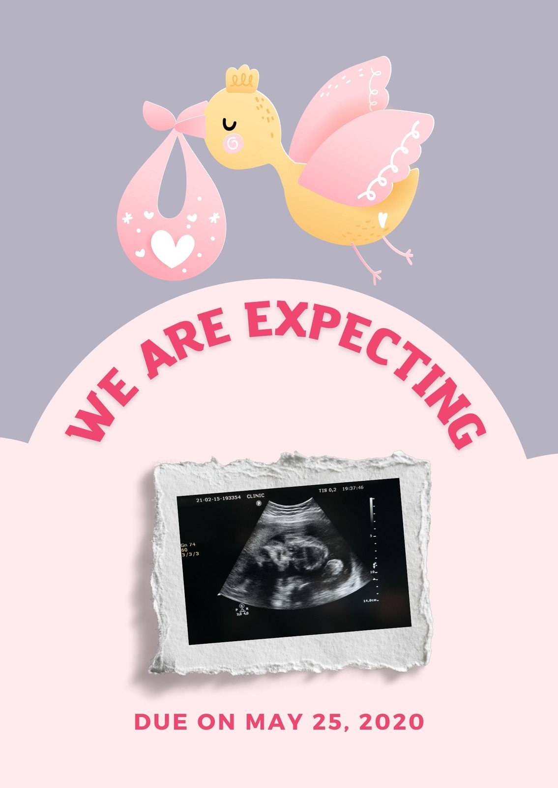 EDITABLE Tie Breaker Pregnancy Announcement Sign New Baby 
