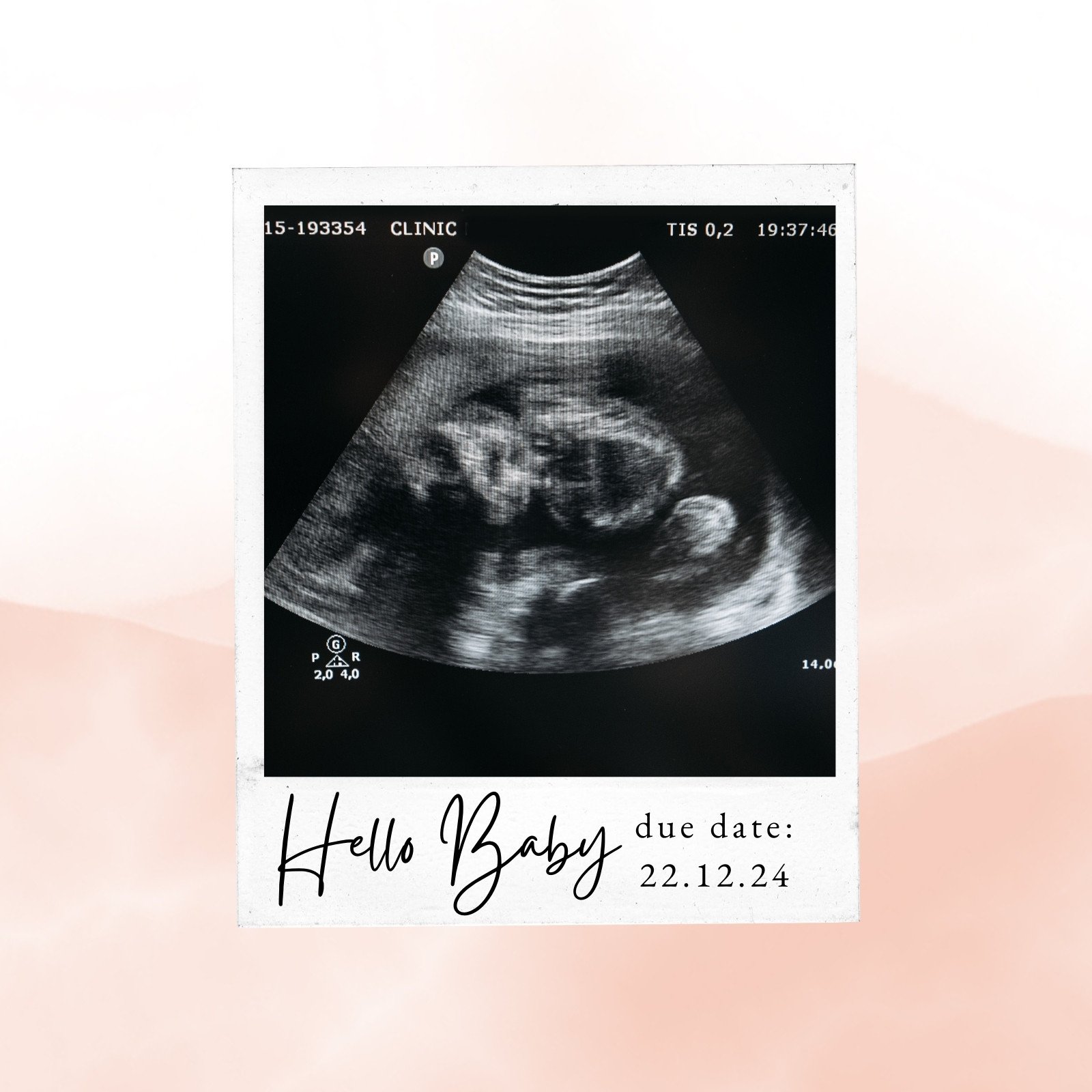 Ultrasound baby photo album -5x7 Ready to ship
