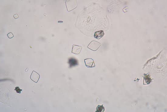 Uric Acid Crystals In Urine Photos By Canva 1877